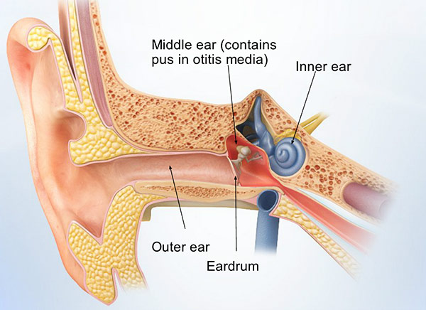 Are Ear Infections Contagious? What You Need to Know